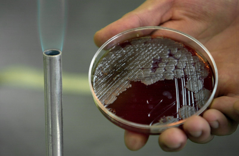 A sample of anthrax bacteria at the National School of Biological Sciences in Mexico City. Anthrax is a bioterrorist’s likely choice because it is easy to produce.