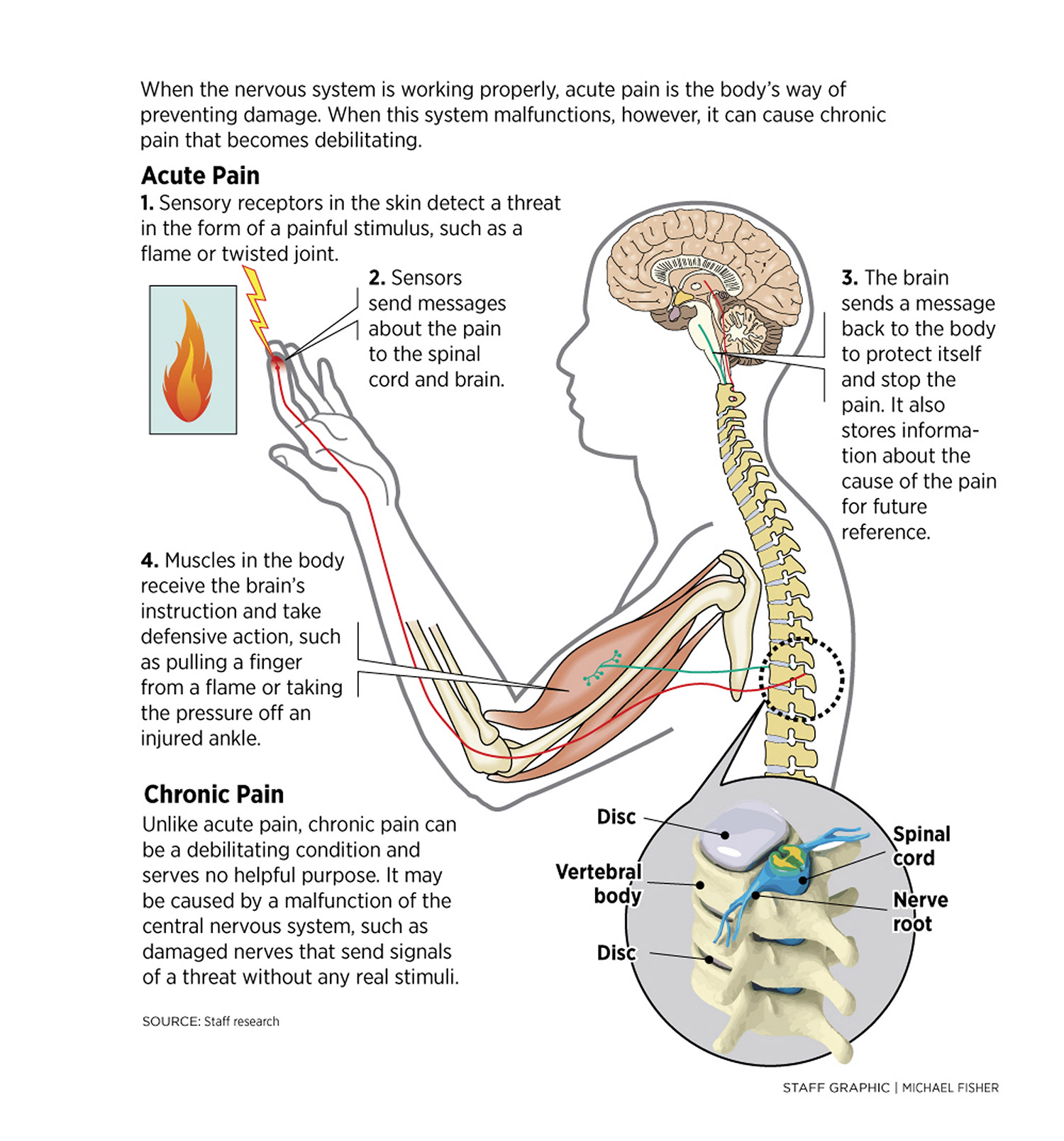 186963-HowPainWorks1214EDITED