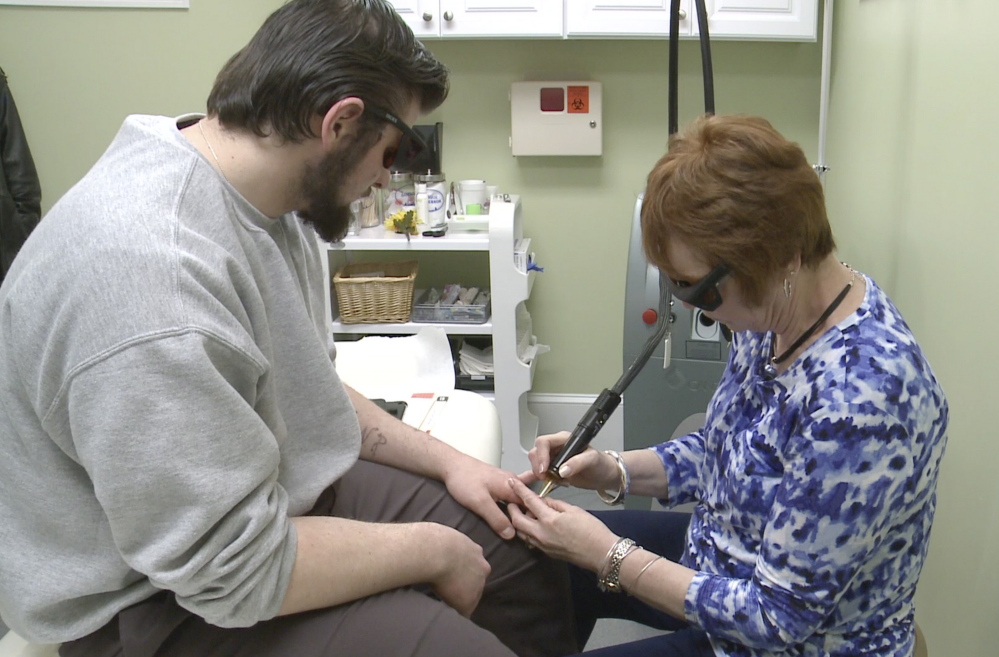 Nonie Letellier, a registerd nurse at the Cosmetic Enhancement Center in Portland, removes tattoos from Damien Clinton’s knuckles. Clinton is a resident at Long Creek Youth Development Center.