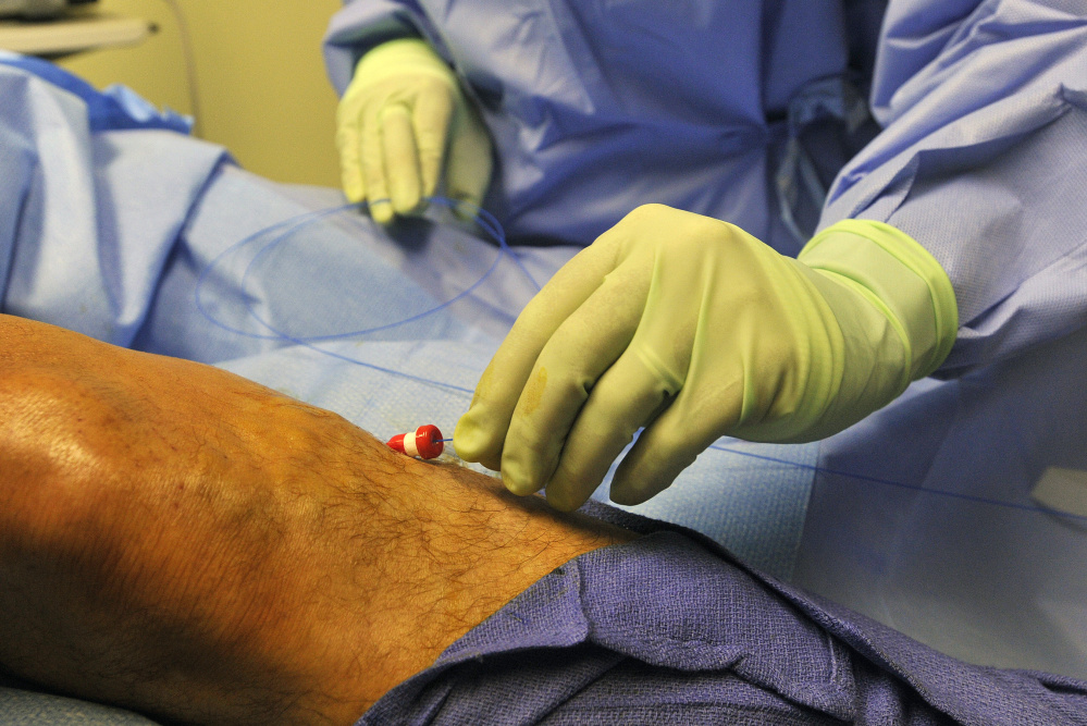 SOUTH PORTLAND, ME - FEBRUARY 28: Dr. Cindy Asbjornsen threads a laser fiber into a patients leg during a laser procedure at Vein Healthcare Center in South Portland Tuesday, February 28, 2017. (Staff photo by Shawn Patrick Ouellette/Staff Photographer)